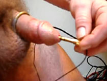 Urethra in electro pain
